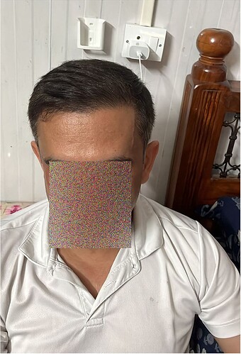 After 7 Months Hair Transplant Picture (1)  The Hairsmith Clinic - We Care For Your Hair