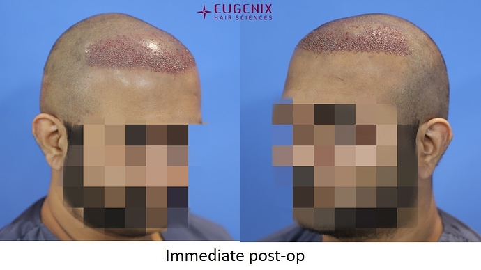 Slide5