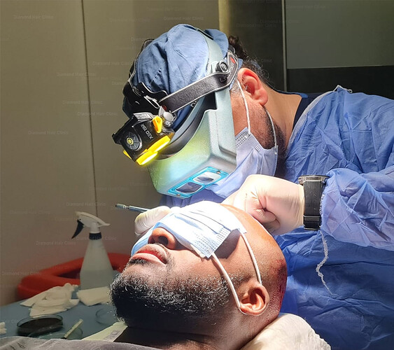 04 - Diamond Hair Clinic - Hair Transplant in Turkey - Dr. Mehmet Demircioglu - Patient Lomew-5