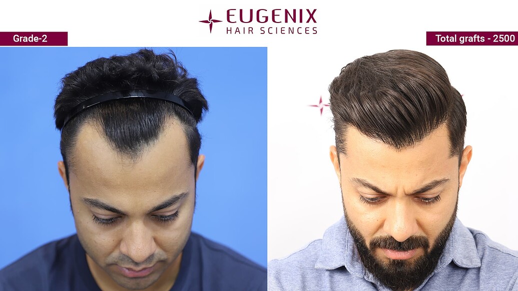 Eugenix Hair Sciences | Is this the best hair line ever created? - Hair ...