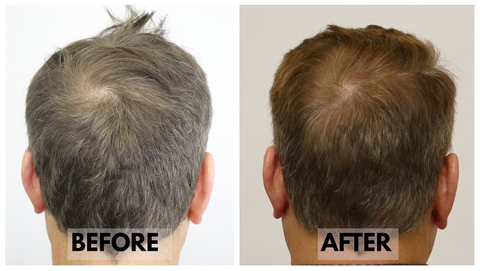 Before-After-Crown1