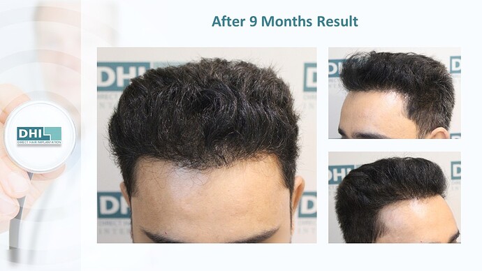 Bilal - Face Blur (1)