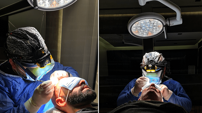 Diamond Hair Clinic - Dr. Mehmet Demircioglu - May 2024 - Doctor involvement in hair transplant surgery.