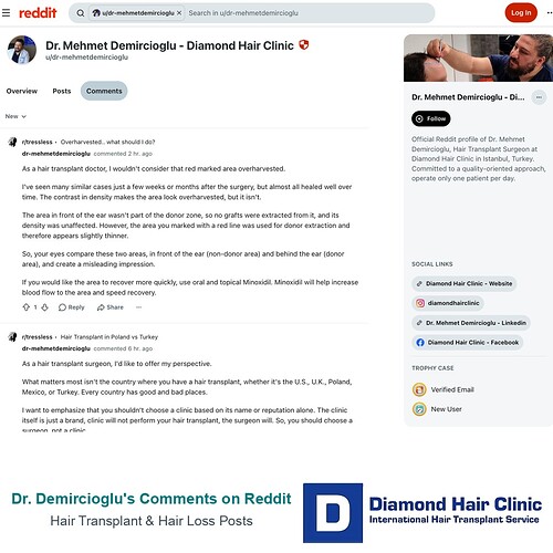Dr. Mehmet Demircioglu - Diamond Hair Clinic - Reddit Profile