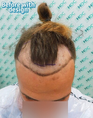 4 before with design