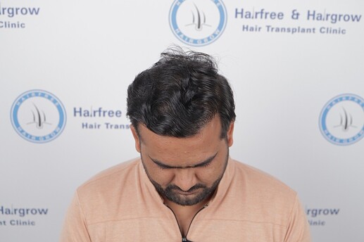 Final Results (12 Months)