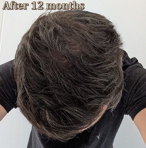 thumbnail_8. One year After top view