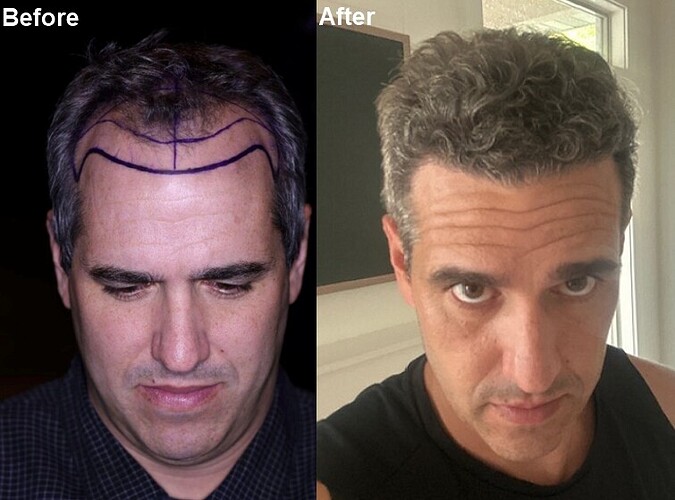 comparison