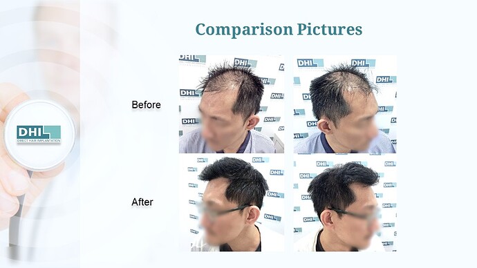 Slide7
