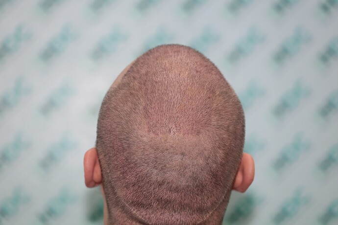 thumbnail_6. five days after Top Back