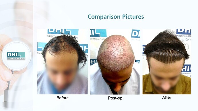Slide6