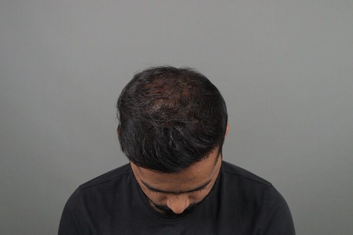 after 1 year and 6 month result