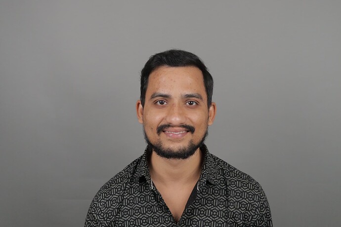 Patient smiles and reveals results after one year of hair transplant at Hair Free & Hair Grow Clinic