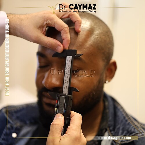 golden-ratio-dr-caymaz-hairline-preparing