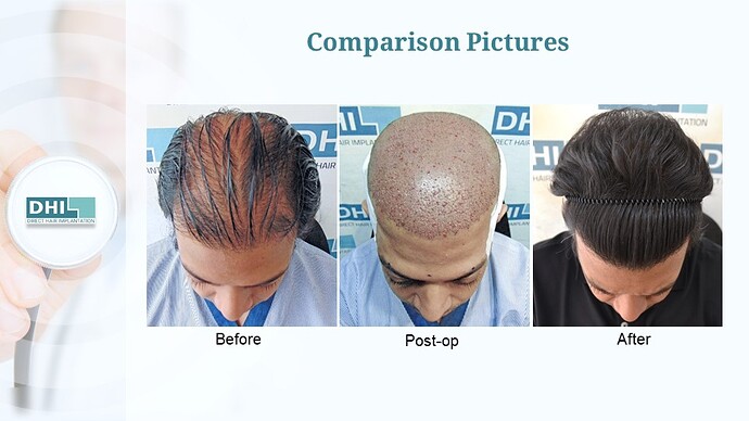 Slide8