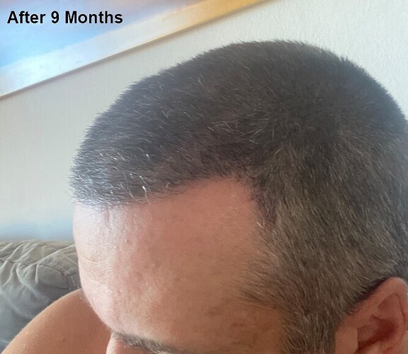 9 months