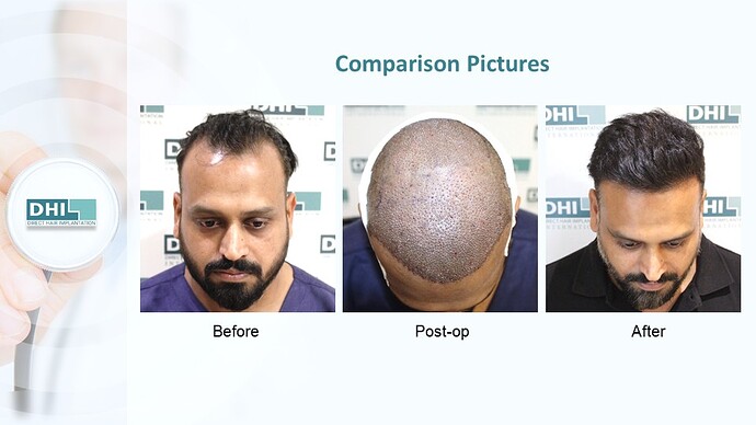 Slide6