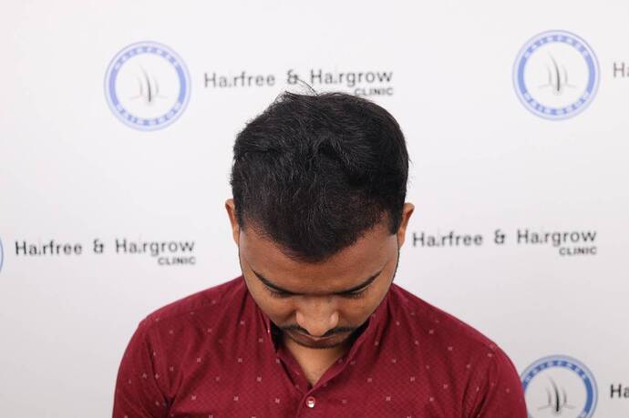 Result after few months