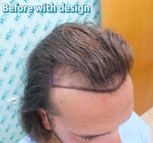 3 Before with Design