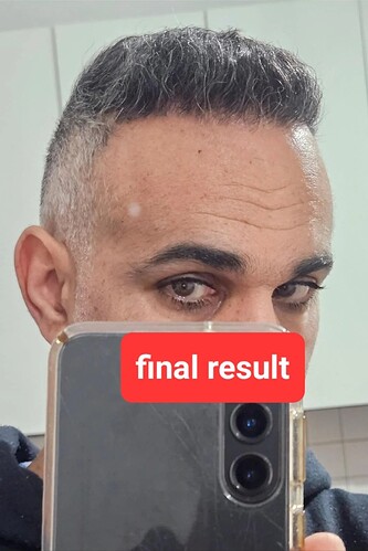 16. Result of FUE2 front