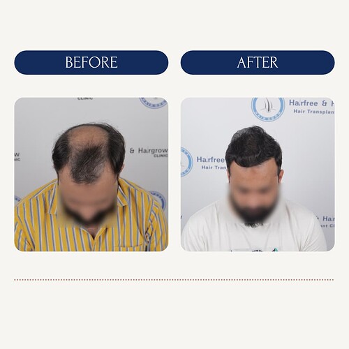 Top-view Before after patients results