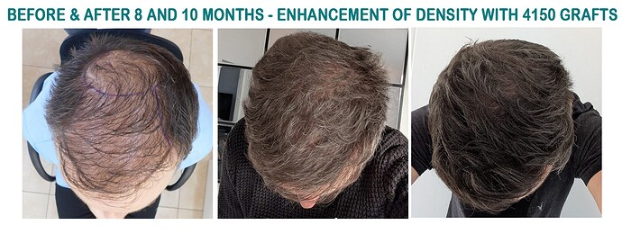 thumbnail_11. Comparison 1
