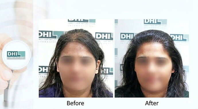 Gemini_Generated_Image_lsc9f7lsc9f7lsc9