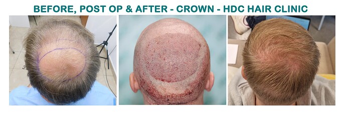 6. comparison with natural result