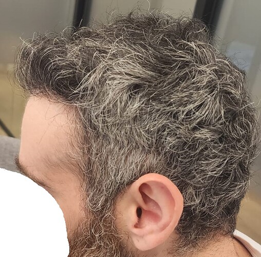 10. side View After