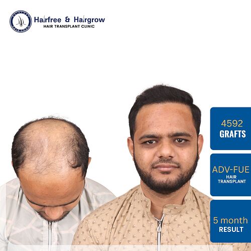 HUZAIFA PATEL.jpg