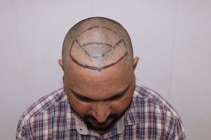 after trimming hair