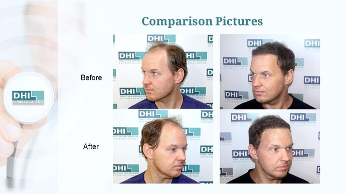 Slide8
