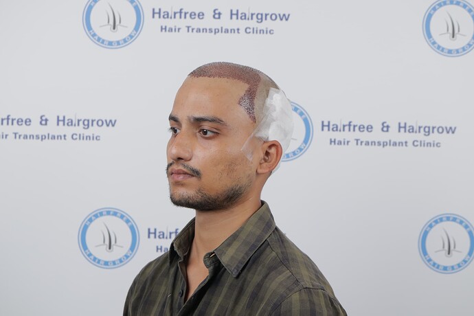 after transplant click