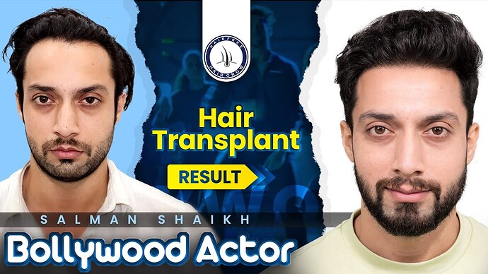 Salman Shaikh's Journey with Hairfree & Hairgrow