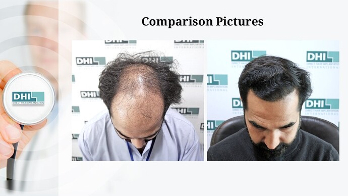 Slide6