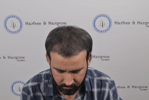 before transplant when he visited clinic