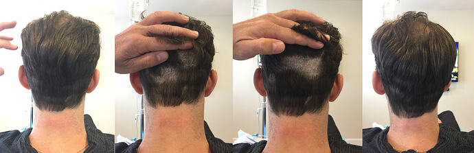 full non shave (1)