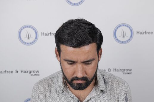 result after few months